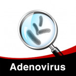 Schema für die Behandlung von Adenovirus in Tauben folgen